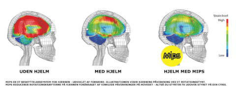 Hvad er MIPS? Guide til teknologien!